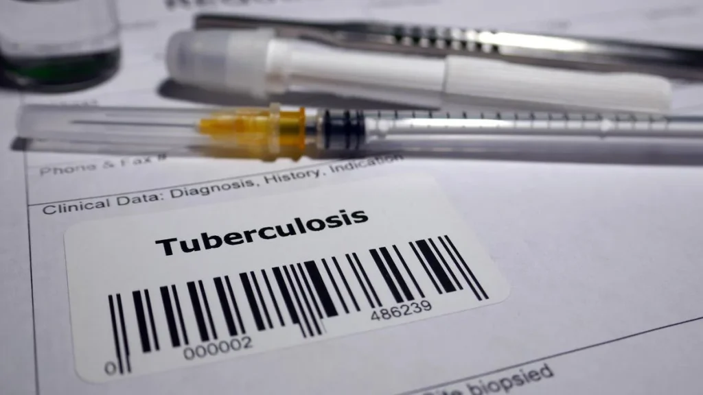 Remodelling of immune system by TB vaccine may explain its link with lower