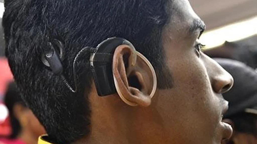 Beyond childhood: the expanding possibilities of cochlear implants for hearing