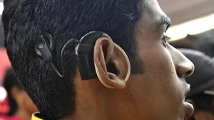 Beyond childhood: the expanding possibilities of cochlear implants for hearing