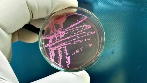 Salmonella outbreak tied to eggs has sickened 98 people since November