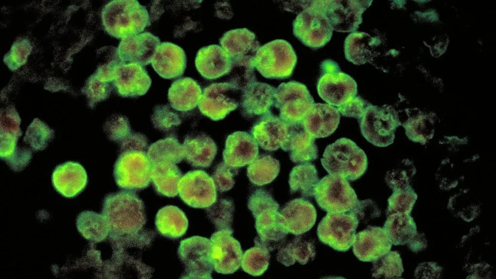 Kerala's Kasaragod reports fresh amoebic brain infection case; 18-year-old in
