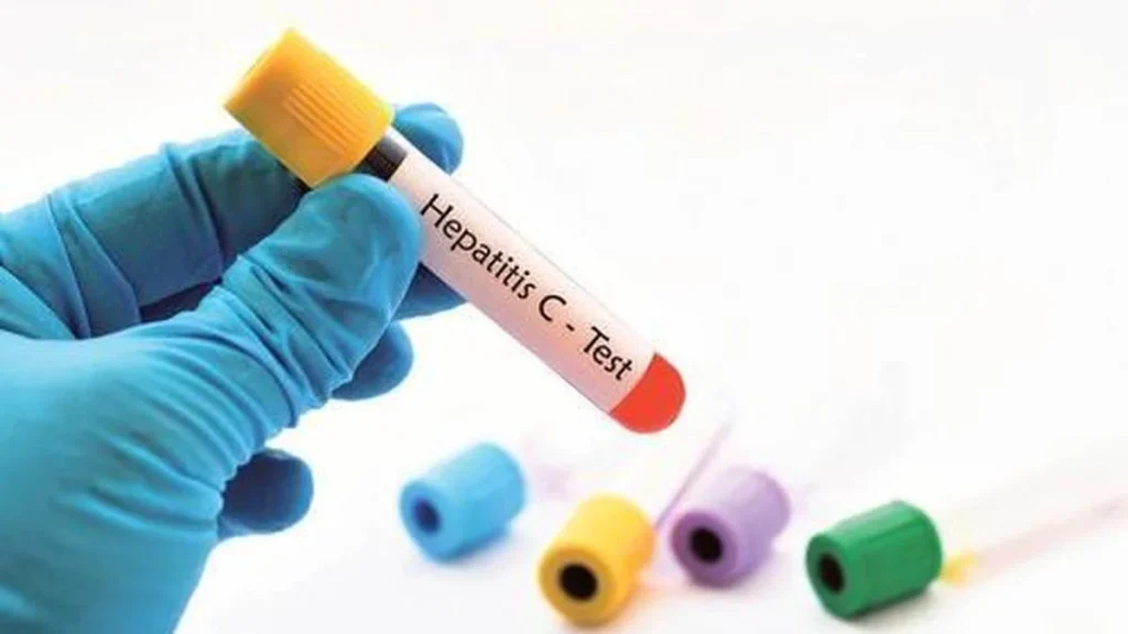 All you need to know about: Hepatitis C