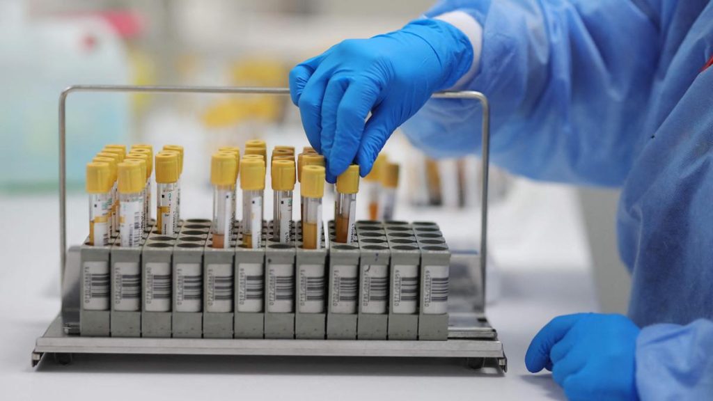 NAT screening facilities should be set up in government and private blood banks across the country