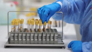 NAT screening facilities should be set up in government and private blood banks across the country