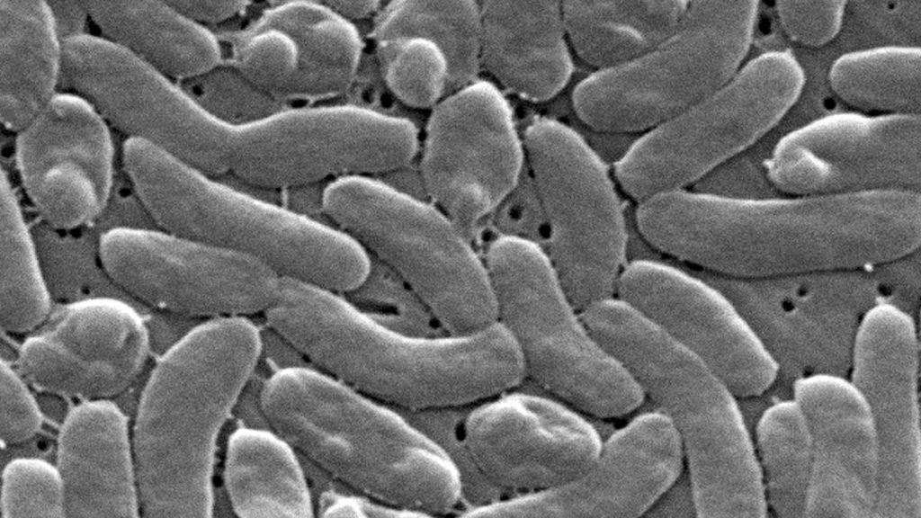 Flesh-eating bacteria sounds like the premise of a bad horror movie, but it’s a growing –