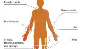 For an unexplained lump with concerning features, diagnosis and planning should come before excision
