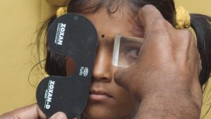 Treatment depends on the type and cause of the squint, the age of the person, how frequently the eye