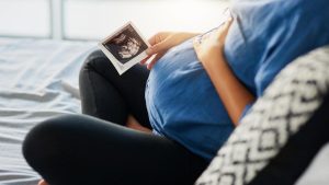 Normal deliveries are declining and C-section deliveries remain high at the Government Hospital