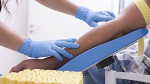 Iron deficiency can develop gradually, with the body’s stored iron being depleted before there