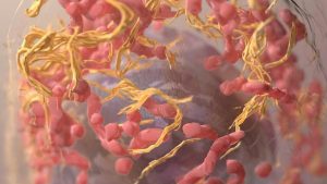 More fundamentally, India needs a national melanoma registry, stronger epidemiological