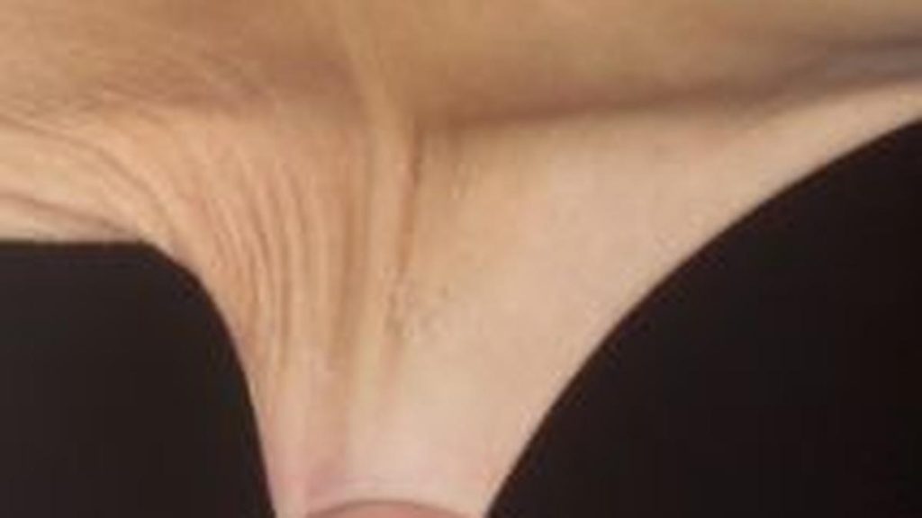 Here’s key details about Ehlers-Danlos Syndrome