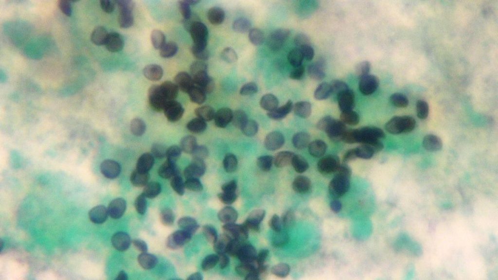 Nonetheless, researchers understand antimicrobial resistance as microorganisms evolving