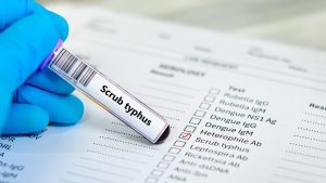What is scrub typhus | Explained