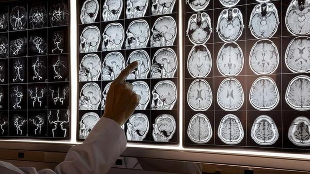 But it is not a medical diagnosis, and persistent cognitive difficulties should not
