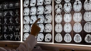 But it is not a medical diagnosis, and persistent cognitive difficulties should not