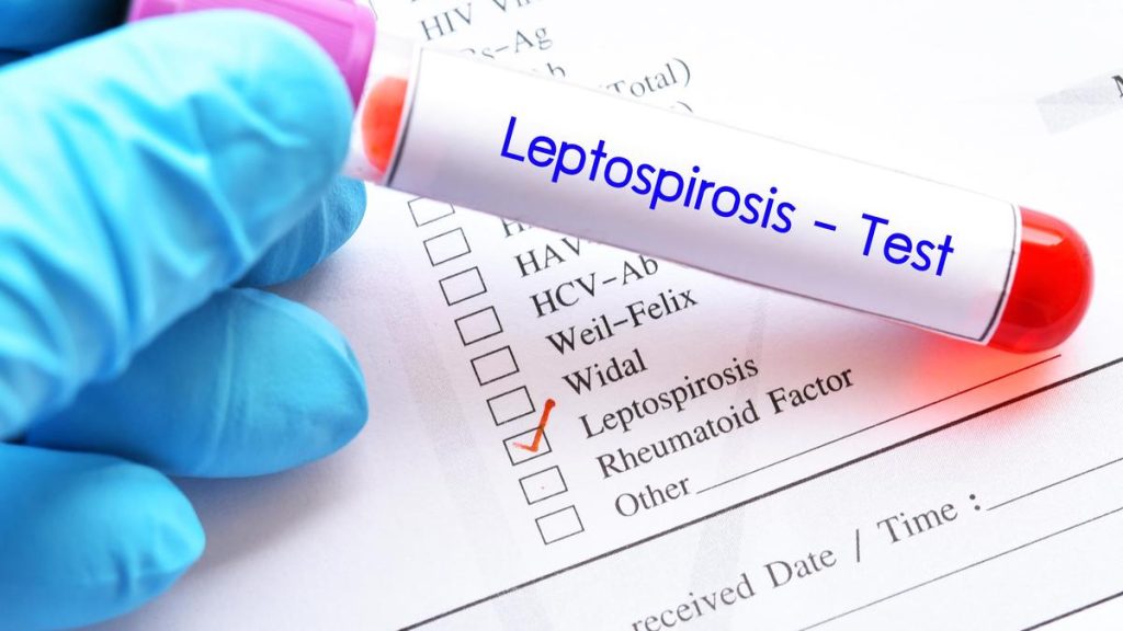 key details about: Leptospirosis